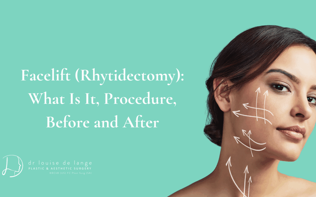 Facelift (Rhytidectomy): What Is It, Procedure, Before and After