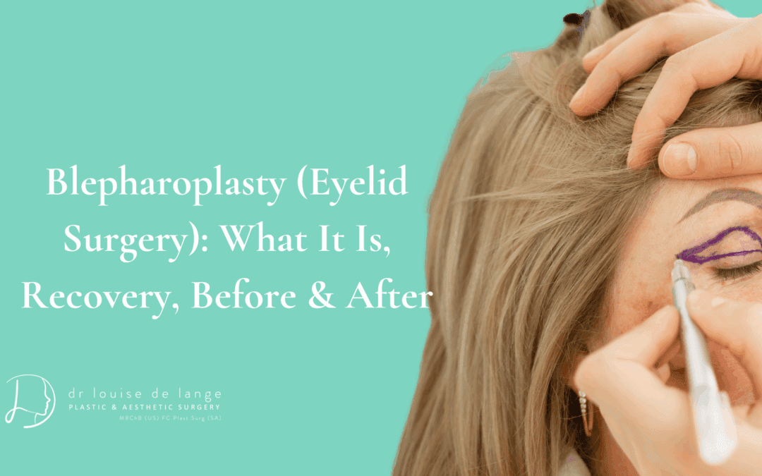 Blepharoplasty (Eyelid Surgery): What It Is, Recovery, Before & After