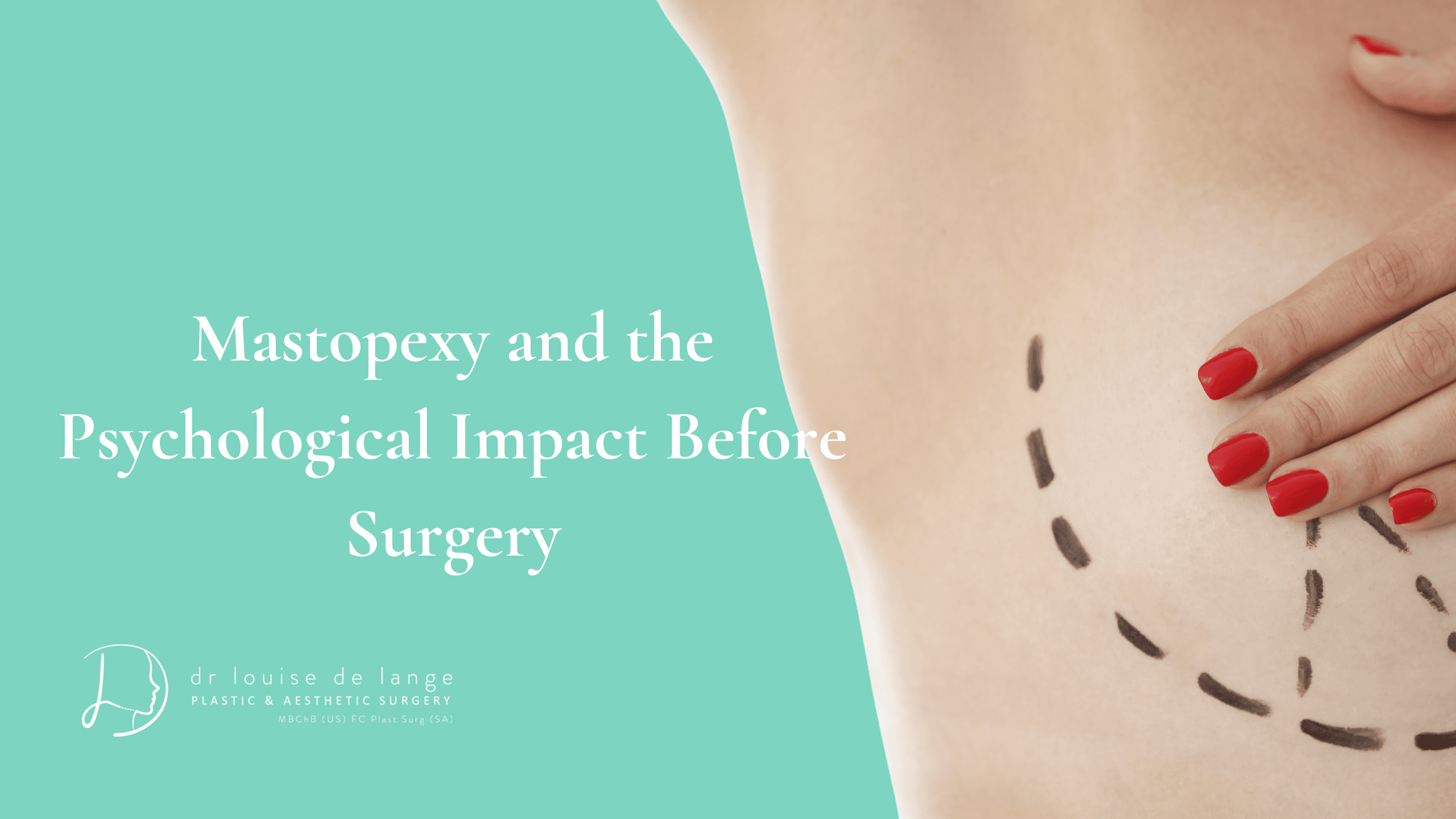 mastopexy and the psychological impact