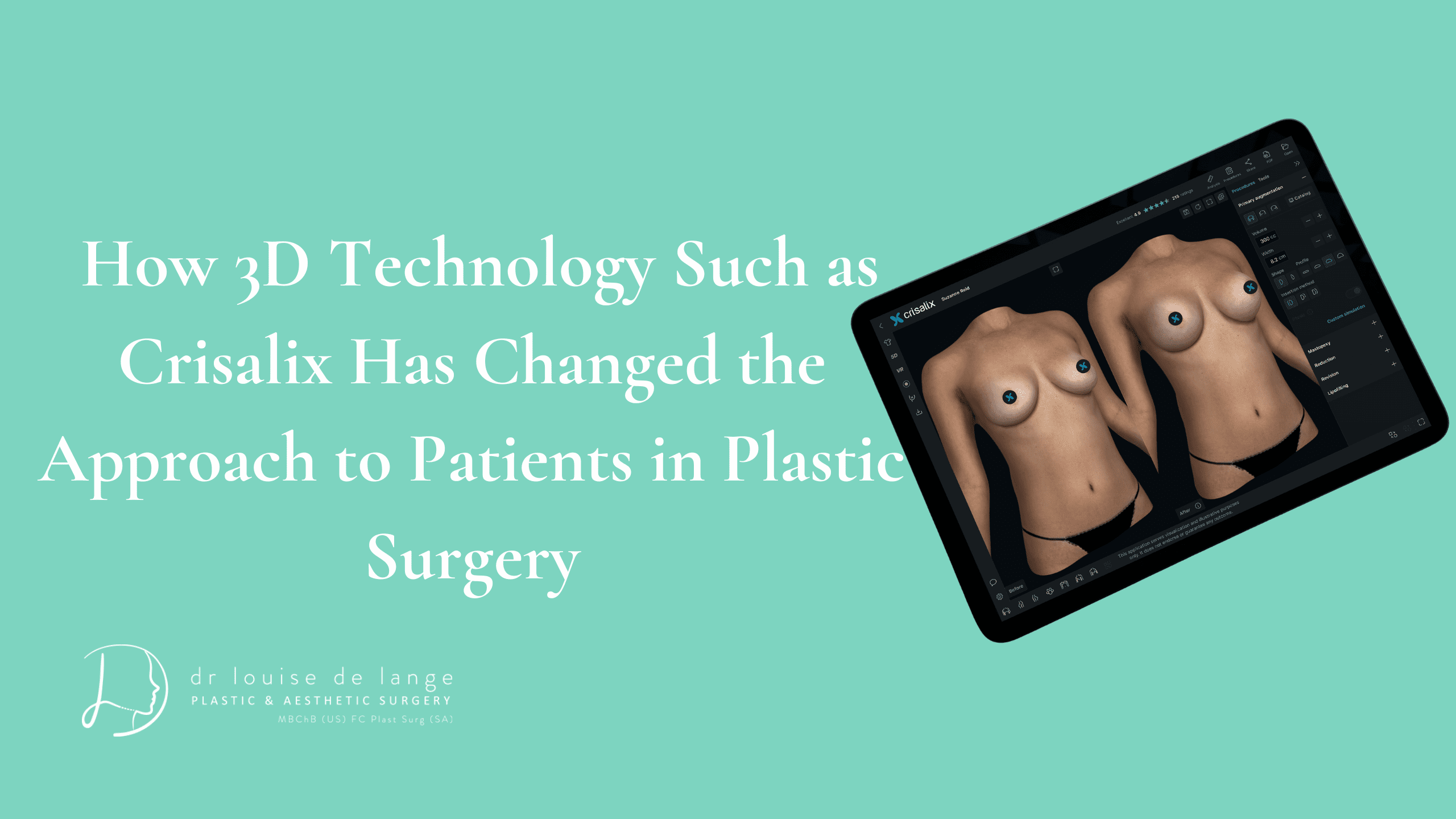 How 3D Technology Such as Crisalix Has Changed the Approach to Patients in Plastic Surgery