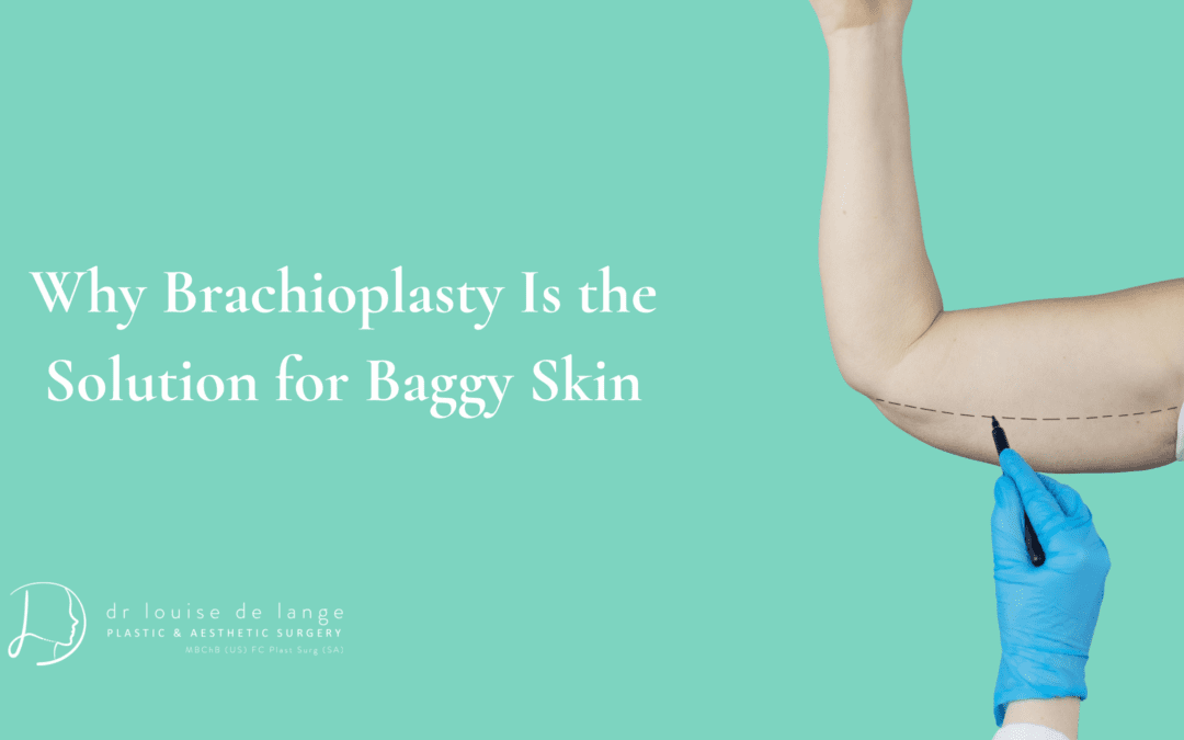Why Brachioplasty Is the Solution for Baggy Skin