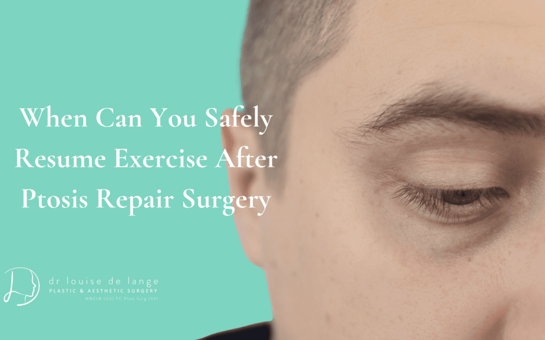 When Can You Safely Resume Exercise After Ptosis Repair Surgery?