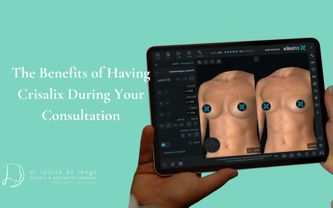 The Benefits of Having Crisalix During Your Consultation