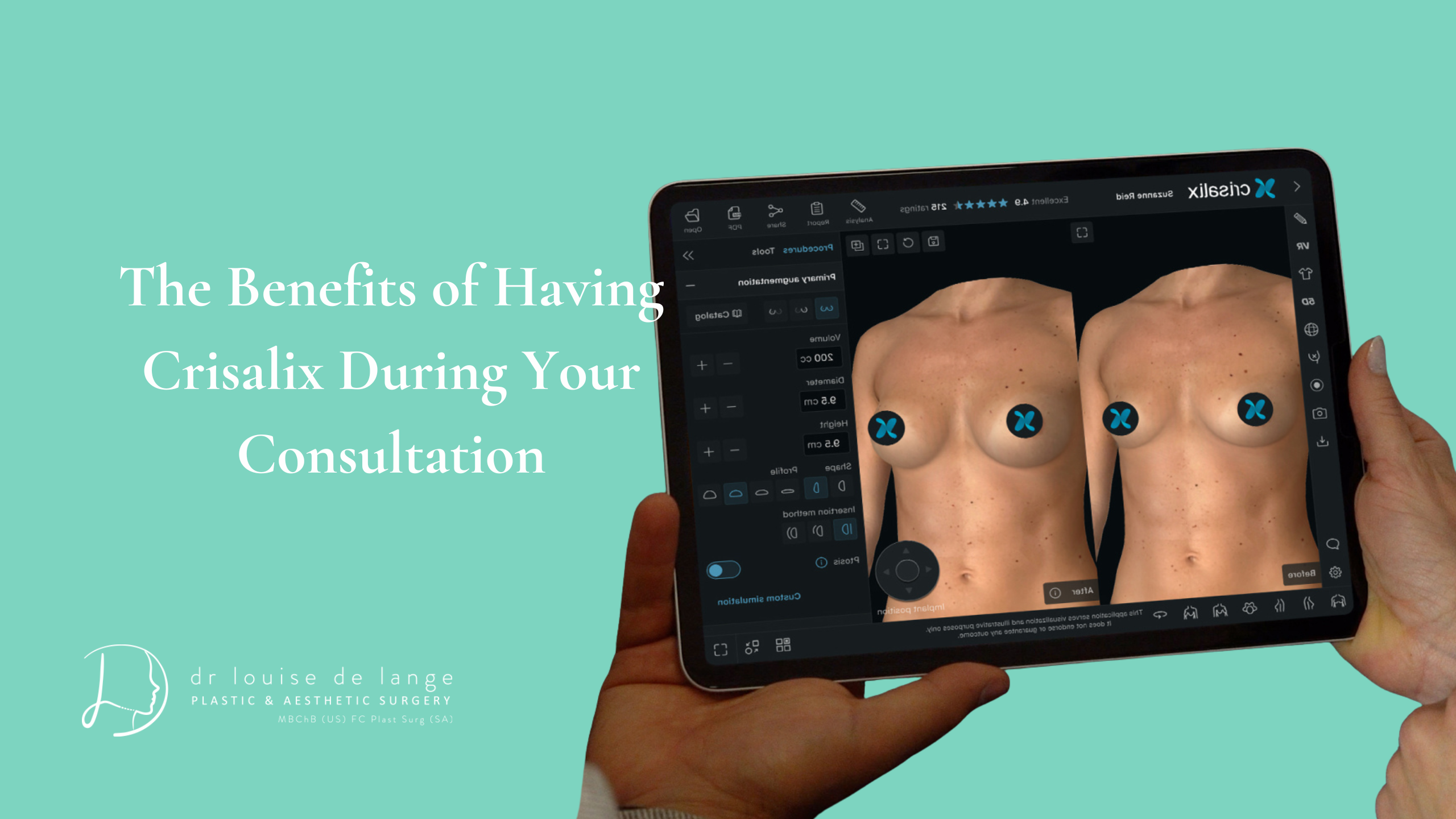 The Benefits of Having Crisalix During Your Consultation